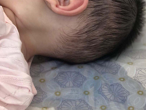 頭部經(jīng)常出汗什么原因，頭部出汗多怎么調(diào)理